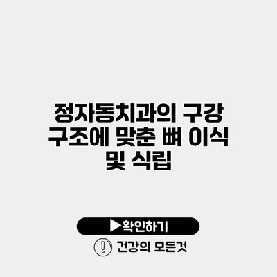 정자동치과의 구강 구조에 맞춘 뼈 이식 및 식립